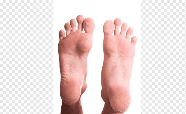 Пятка без фона