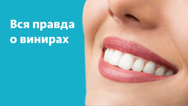 Виниры для зубов