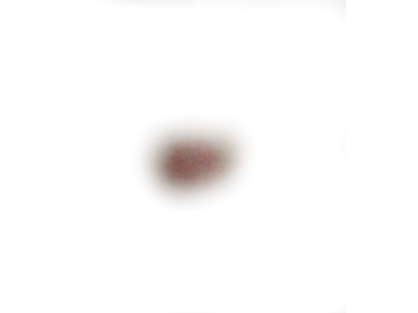 Кровоподтеки на прозрачном фоне